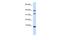 Diazepam Binding Inhibitor, Acyl-CoA Binding Protein antibody, PA5-40659, Invitrogen Antibodies, Western Blot image 