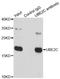 Ubiquitin Conjugating Enzyme E2 C antibody, LS-C334094, Lifespan Biosciences, Immunoprecipitation image 