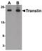 Translin antibody, PA5-21150, Invitrogen Antibodies, Western Blot image 