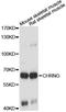 Cholinergic Receptor Nicotinic Gamma Subunit antibody, A7884, ABclonal Technology, Western Blot image 