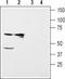 Potassium Voltage-Gated Channel Subfamily J Member 16 antibody, TA328976, Origene, Western Blot image 