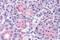 Parathyroid Hormone 2 Receptor antibody, GTX70615, GeneTex, Immunohistochemistry paraffin image 