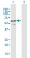 Zinc Finger Protein 415 antibody, H00055786-B01P, Novus Biologicals, Western Blot image 