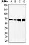 Lymphocyte Cytosolic Protein 2 antibody, GTX32209, GeneTex, Western Blot image 