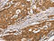 Diacylglycerol O-Acyltransferase 1 antibody, CSB-PA932813, Cusabio, Immunohistochemistry frozen image 
