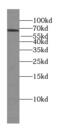Tudor and KH domain-containing protein antibody, FNab08580, FineTest, Western Blot image 