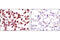 ERBB2 antibody, 4290P, Cell Signaling Technology, Immunohistochemistry paraffin image 