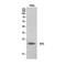 Neurotensin antibody, STJ96900, St John