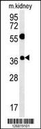 Tetraspanin 3 antibody, 61-974, ProSci, Western Blot image 