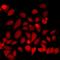 Structural Maintenance Of Chromosomes 1A antibody, LS-C667883, Lifespan Biosciences, Immunofluorescence image 