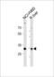 Calbindin 1 antibody, LS-C204028, Lifespan Biosciences, Western Blot image 