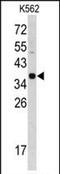 Cathepsin E antibody, PA5-72460, Invitrogen Antibodies, Western Blot image 