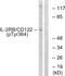 Interleukin 2 Receptor Subunit Beta antibody, 79-816, ProSci, Western Blot image 