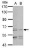 Transferrin Receptor 2 antibody, PA5-28983, Invitrogen Antibodies, Western Blot image 