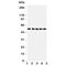 SMAD Family Member 6 antibody, R31249, NSJ Bioreagents, Western Blot image 