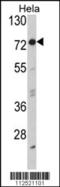 Eukaryotic Translation Initiation Factor 2 Alpha Kinase 1 antibody, MBS9206335, MyBioSource, Western Blot image 