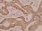 Adrenoceptor Beta 2 antibody, A00072, Boster Biological Technology, Immunohistochemistry frozen image 