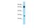 Eukaryotic Translation Initiation Factor 4E Family Member 1B antibody, A15694, Boster Biological Technology, Western Blot image 