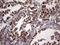 ATP Synthase Peripheral Stalk Subunit OSCP antibody, NBP2-46555, Novus Biologicals, Immunohistochemistry frozen image 