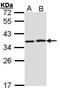 HCLS1 Associated Protein X-1 antibody, PA5-27592, Invitrogen Antibodies, Western Blot image 