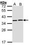 HCLS1-associated protein X-1 antibody, PA5-27592, Invitrogen Antibodies, Western Blot image 