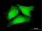 RNA Pseudouridine Synthase D3 antibody, H00285367-B01P, Novus Biologicals, Immunocytochemistry image 