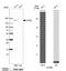 Lysine Acetyltransferase 6B antibody, NBP1-92036, Novus Biologicals, Western Blot image 