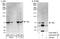 Nuclear Receptor Subfamily 2 Group C Member 1 antibody, A303-047A, Bethyl Labs, Western Blot image 