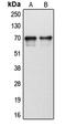 Cytochrome P450 Family 1 Subfamily B Member 1 antibody, LS-C352082, Lifespan Biosciences, Western Blot image 