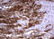 TNKS antibody, LS-C175351, Lifespan Biosciences, Immunohistochemistry paraffin image 