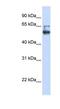 Membrane Bound O-Acyltransferase Domain Containing 7 antibody, NBP1-62511, Novus Biologicals, Western Blot image 
