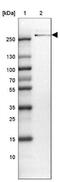 Teneurin Transmembrane Protein 3 antibody, NBP2-13687, Novus Biologicals, Western Blot image 