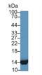 Fatty Acid Binding Protein 1 antibody, LS-C304349, Lifespan Biosciences, Western Blot image 