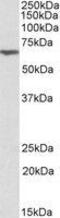 Anthrax toxin receptor 2 antibody, GTX88121, GeneTex, Western Blot image 