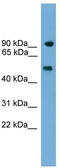 Poly(ADP-Ribose) Polymerase Family Member 8 antibody, TA329552, Origene, Western Blot image 