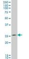 Thiamine Triphosphatase antibody, H00079178-M01, Novus Biologicals, Western Blot image 