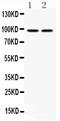 Aryl Hydrocarbon Receptor antibody, PB9419, Boster Biological Technology, Western Blot image 