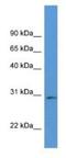 Ribose 5-Phosphate Isomerase A antibody, NBP1-79588, Novus Biologicals, Western Blot image 