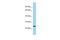 Insulin Like Growth Factor Binding Protein Like 1 antibody, PA5-70786, Invitrogen Antibodies, Western Blot image 