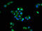 Glutamate Ionotropic Receptor Kainate Type Subunit 1 antibody, LS-C670228, Lifespan Biosciences, Immunofluorescence image 