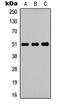 POTE Ankyrin Domain Family Member A antibody, LS-C358243, Lifespan Biosciences, Western Blot image 