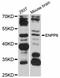Ectonucleotide Pyrophosphatase/Phosphodiesterase 6 antibody, abx125816, Abbexa, Western Blot image 