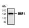 Inositol Polyphosphate-5-Phosphatase D antibody, PA5-17390, Invitrogen Antibodies, Western Blot image 