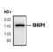 Inositol Polyphosphate-5-Phosphatase D antibody, PA5-17390, Invitrogen Antibodies, Western Blot image 