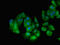 Transportin 3 antibody, LS-C679853, Lifespan Biosciences, Immunofluorescence image 