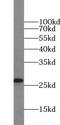 Orosomucoid 2 antibody, abx236013, Abbexa, Western Blot image 
