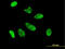 Caudal Type Homeobox 1 antibody, LS-C196892, Lifespan Biosciences, Immunofluorescence image 