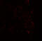 Zinc Finger MYM-Type Containing 3 antibody, A08961, Boster Biological Technology, Immunofluorescence image 