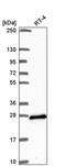 ADP Ribosylation Factor Like GTPase 15 antibody, PA5-66639, Invitrogen Antibodies, Western Blot image 