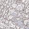 MDIG antibody, FNab05190, FineTest, Immunohistochemistry frozen image 